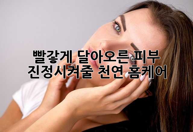 빨갛게 달아오른 피부, 진정시켜줄 천연 홈케어!